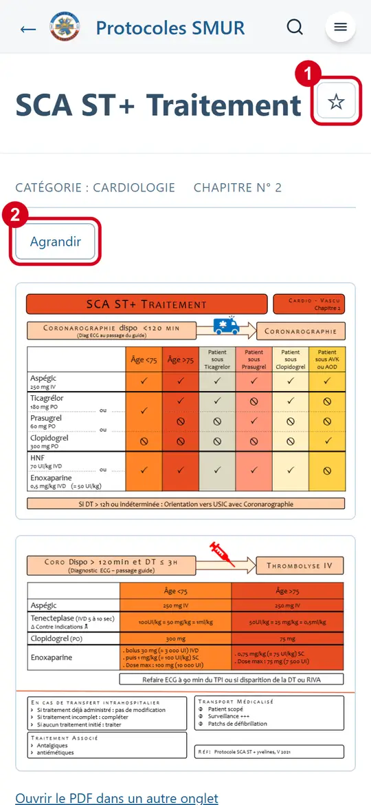 Fiche protocole SCA ST+ : l'étoile des favoris (1) et le bouton Agrandir (2) sont entourés